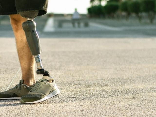 Pose de Prothèse : Préparation, Ajustement et Réadaptation : Orthopédie Stabel 